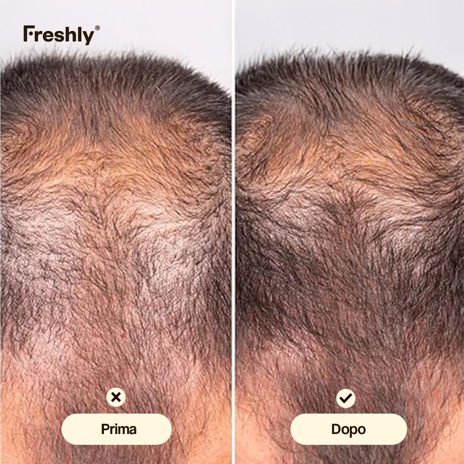 Freshly - Trattamento Serum Capillare Anticaduta Hair Growth & Density Treatment - Formula 99,9% Naturale - Per la Crescita e la Densità dei Capelli - Capelli Forti e Sani - 50 ml