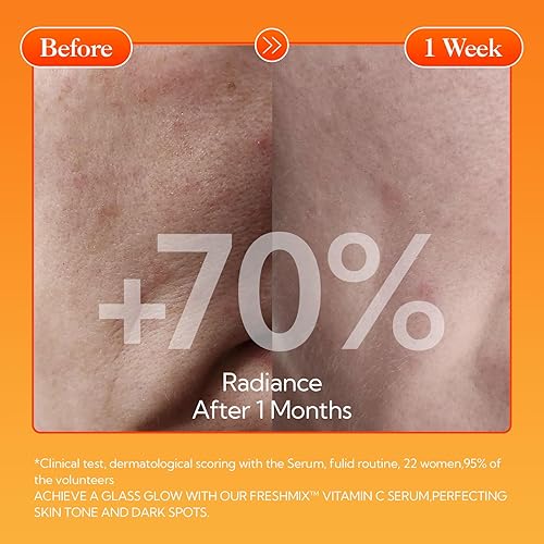 Miniatura 3 de LANBENA Revolucionario suero de vitamina C para cara, suero iluminador de Fcae con niacinamida, esencia iluminadora antienvejecimiento para pieles