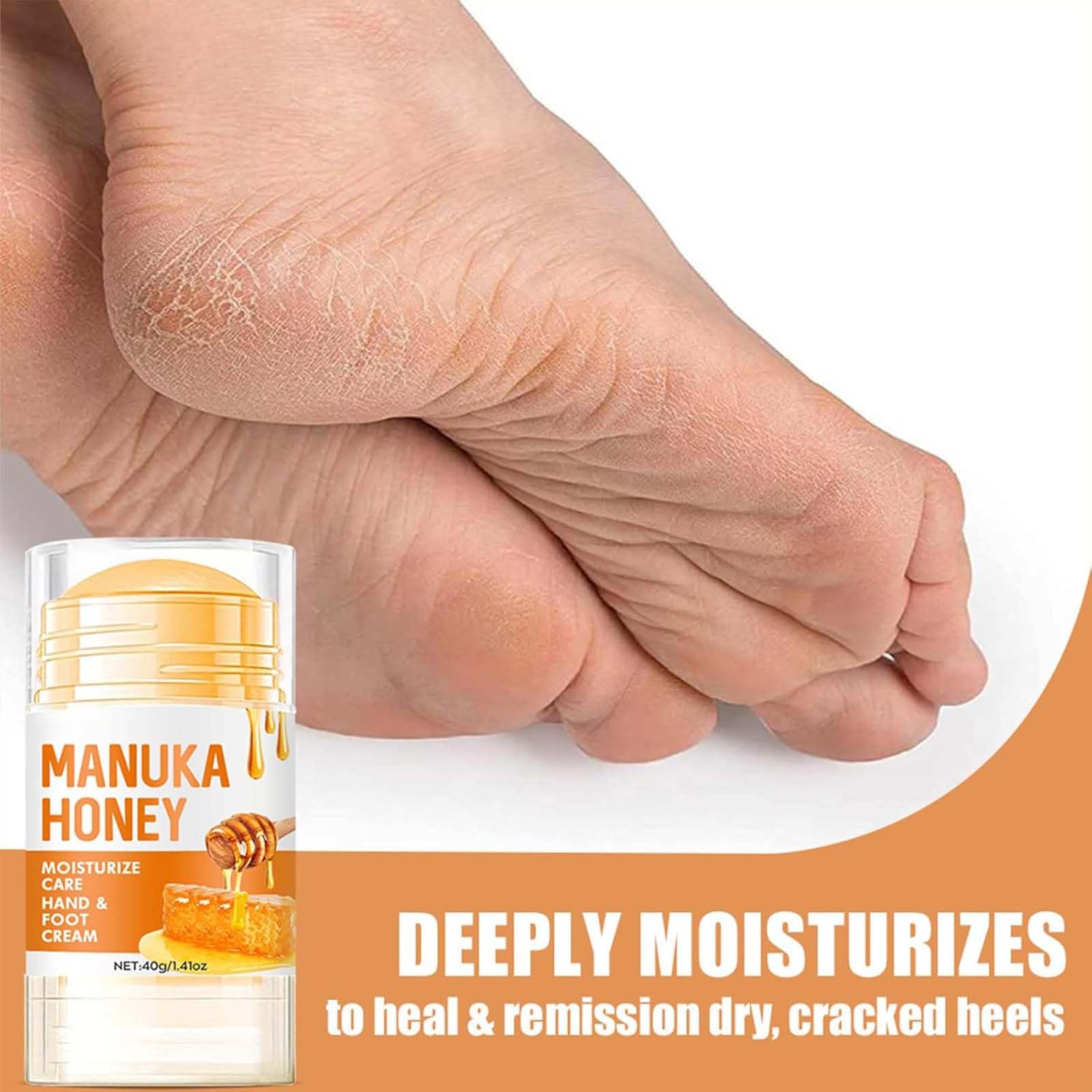 Intensive Honey Foot & Hand Cream for Dry Cracked Skin - Moisturize Heels & Hands for Men & Women - 40g (40 Ml, 1pcs) - Image 2