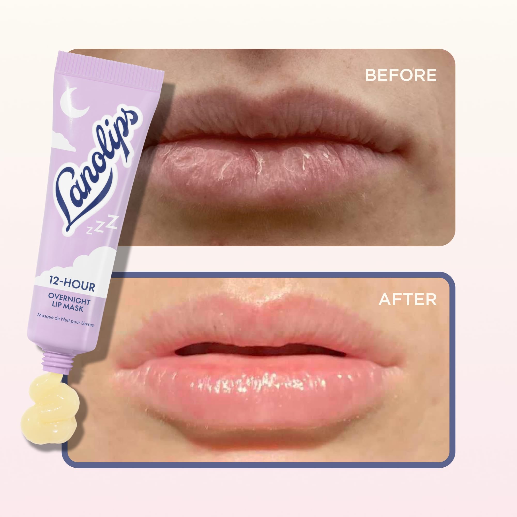 12-Stunden-Übernachtungs-Lippenmaske, reichhaltige Lippen-Feuchtigkeitscreme mit Hyaluronsäure, Vitamin C und Ceramiden, stellt die Lippen wieder her, erweicht und füllt sie auf, während Sie schlafen