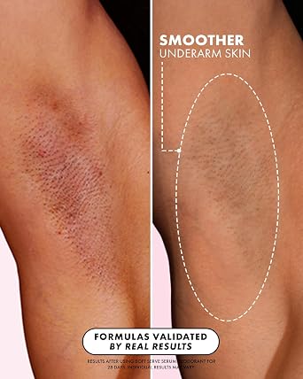 Truly Beauty Soft Serve Serum Deodorant | Aluminum-Free AHA Deodorant with Vitamin C & Niacinamide | Brightening Underarm Deodorant for Odor, Discoloration & Ingrown Hairs | 1.7 fl oz