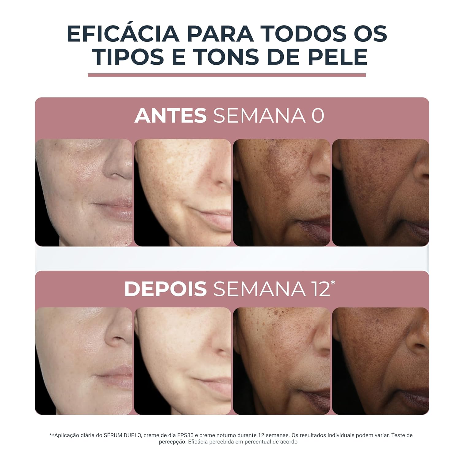 Kit Eucerin Dual Sérum Facial AntiManchas e Anti-idade 30ml + Eucerin Protetor Solar Facial Hydrofluid FPS 60 em promoção! Veja a oferta e mais achadinhos de Rosto 5 Hoje é o melhor dia para comprar Kit Eucerin Dual Sérum Facial AntiManchas e Anti-idade 30ml + Eucerin Protetor Solar Facial Hydrofluid FPS 60 com aquele preço maroto! Promoção! Aproveite a oferta! 5