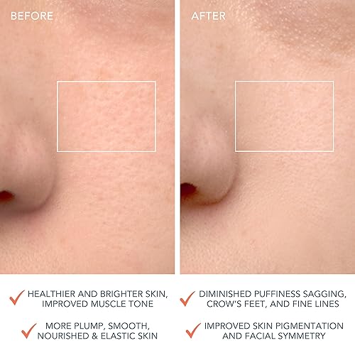 Miniatura 5 de FOREO LUNA 4 Cepillo de limpieza facial - Antienvejecimiento - Mejora la absorción de productos para el cuidado de la piel facial - Herramientas