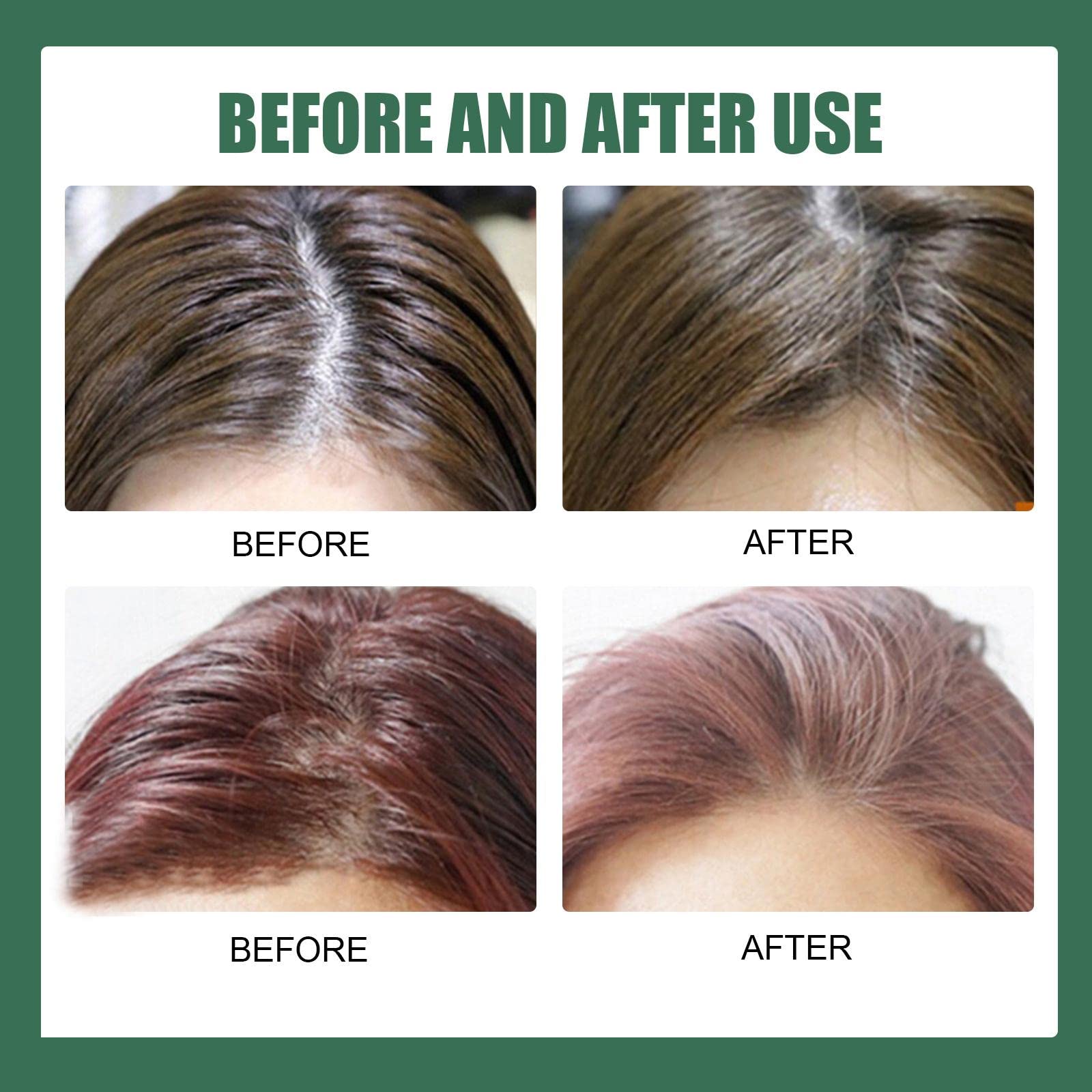 Harilla 6x 100 Ml 3,38 Unzen Spray für Trockenes Haar, Portable, Versetzbar, Ölkontrolle, Praktisch, Kein Waschen, Haarspray, Haarstyling Spray, Trockenshampo
