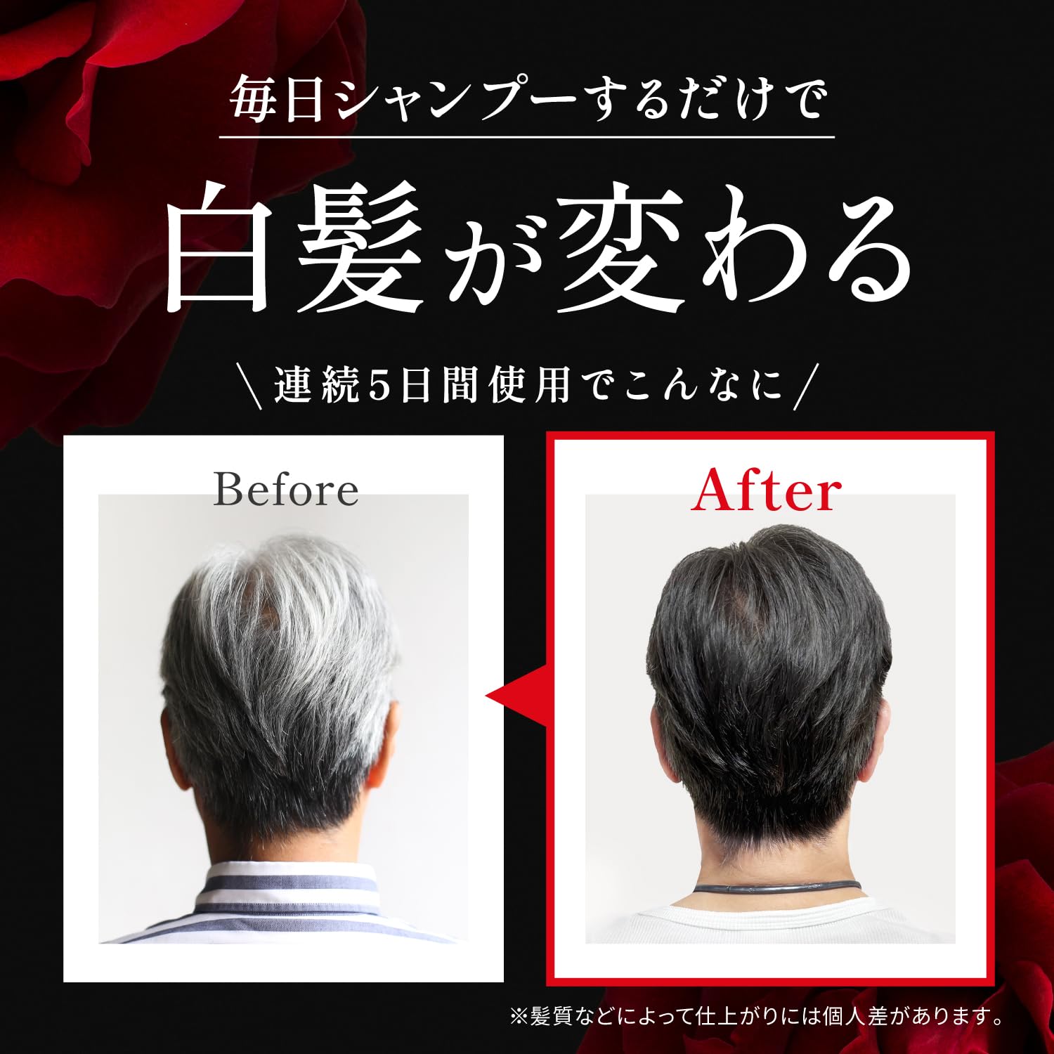 Amazon.co.jp: KUROクリームシャンプー[バランローズ VALANROSE] 400g  