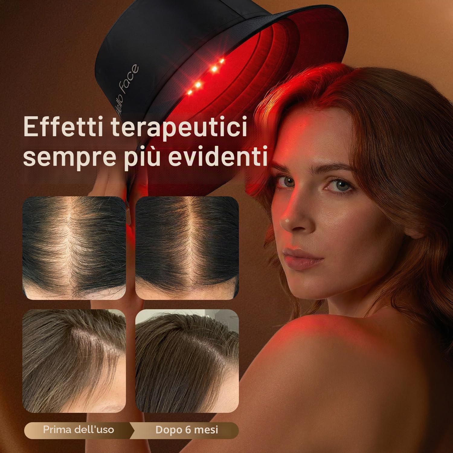 Cappello Terapia Luce Rossa, 336 LED 660 nm & 850 nm Infrarossi, Design a Cappello da Pescatore fino a 62 cm, Cura Professionale per la Salute dei Capelli