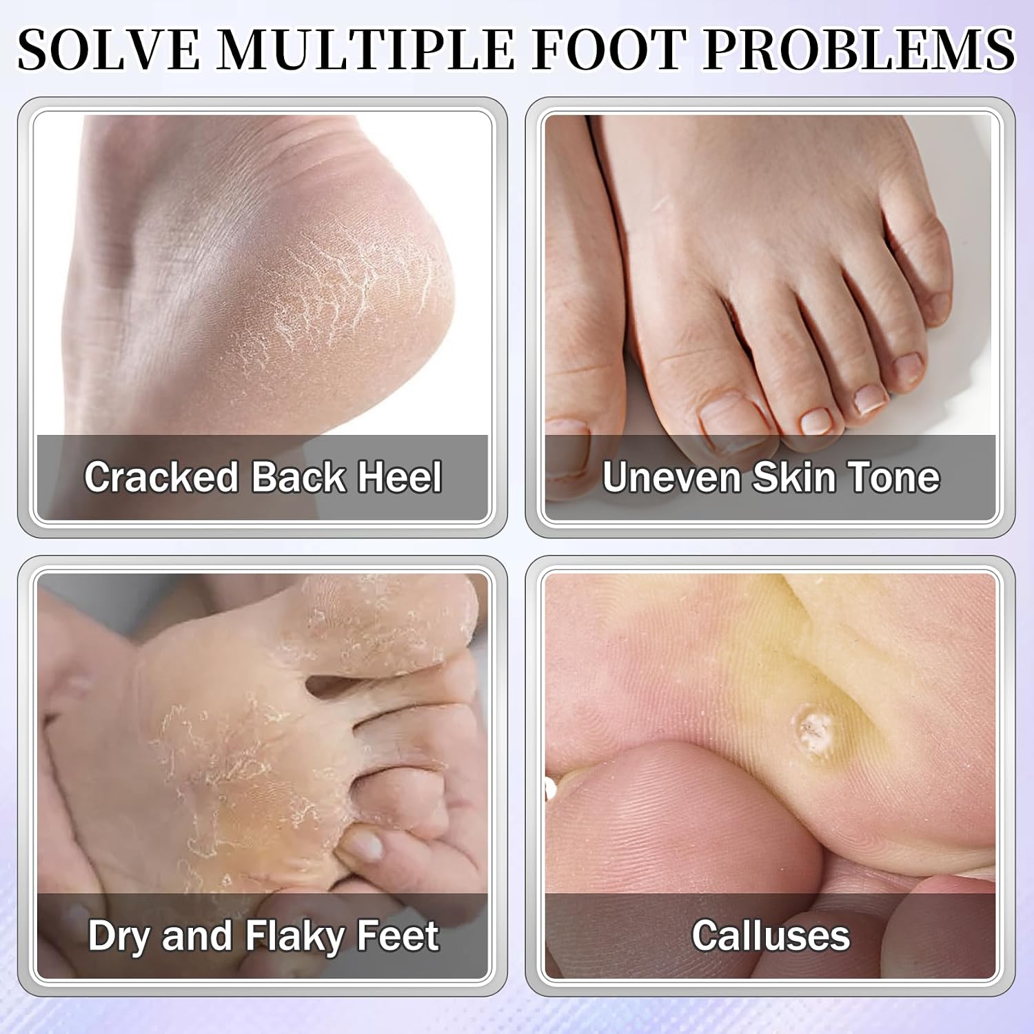 AIUEO 10PCS Moisturizing Foot Mask Set for Dry Cracked Feet, Foot Care Kit | Hydrating Foot Masks, Smooth and Nourishing, Relieve Dry Skin, Foot Care Spa Kit for Men& Women