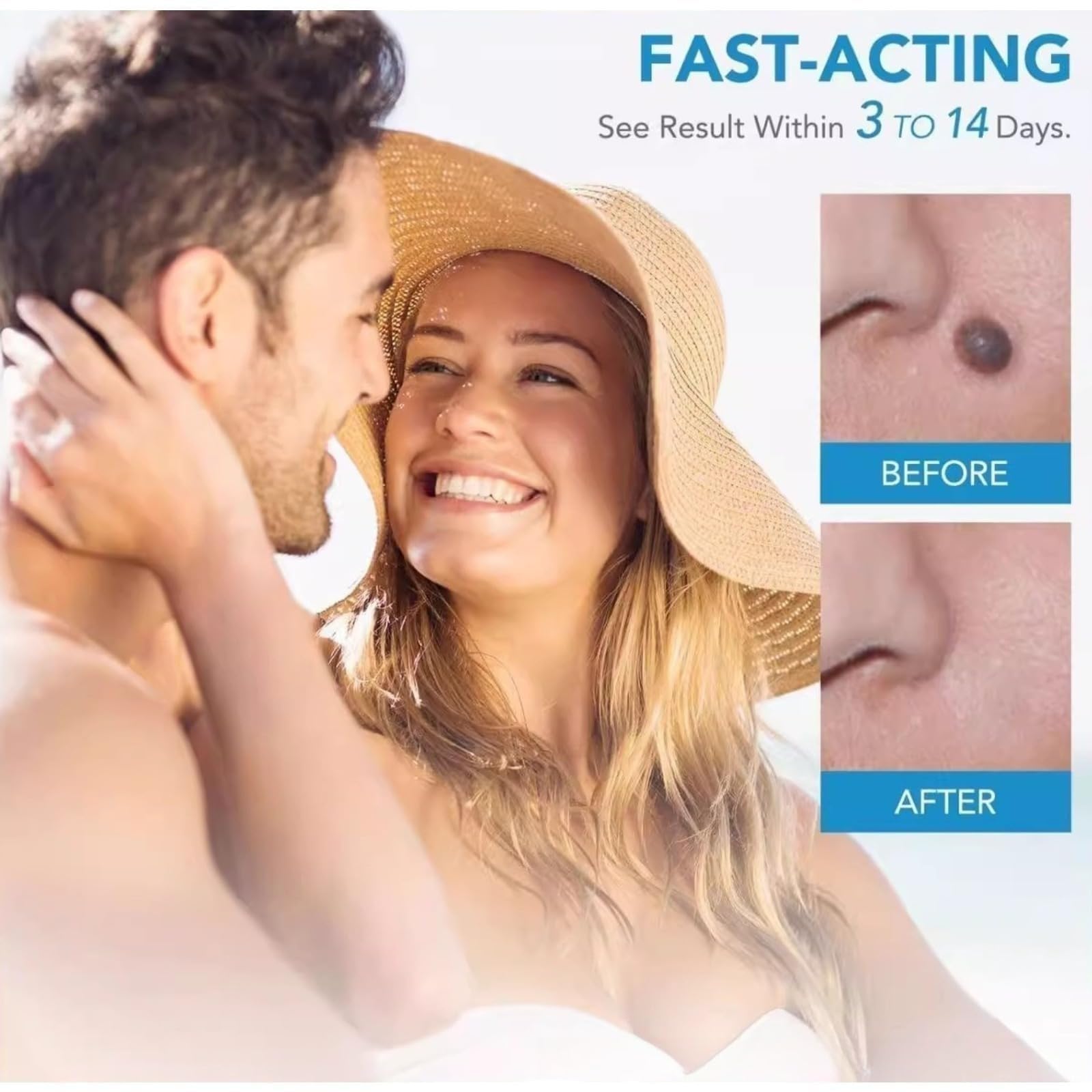 DermaSkin Pro – Kit correcteur cutané, adieu acrochordons, soin indolore à domicile (1 Kit)