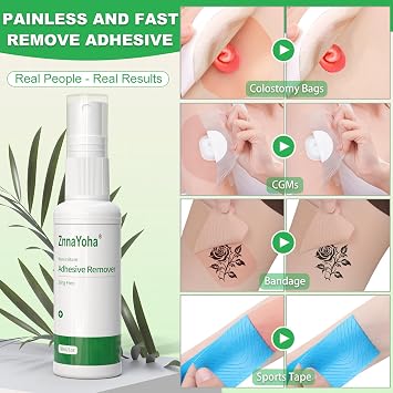 Adhesive Remover Spray,No Sting Medical Adhesive Remover for Skin,Ideal for Ostomy Patients, Sensitive Skin and Bandage Removal, Alcohol Free,1oz/ 30ml