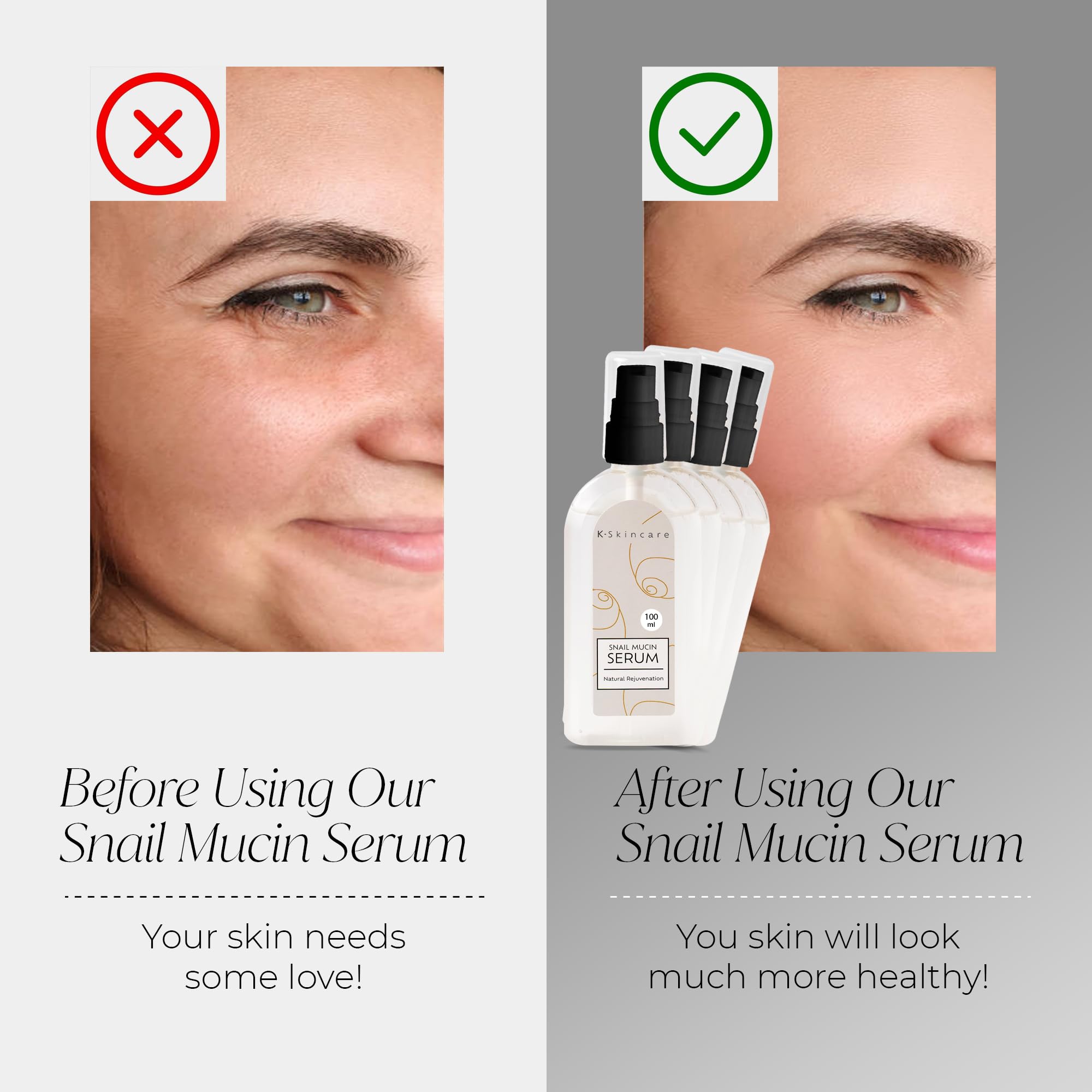 x4 Snail Mucin Essence Serum & Hyaluronic Acid, All In One Advanced Skin Repair, Deep Hydration, Blemish & Fine Line Removal - Image 2