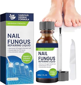 Nail Repair Liquid, Toenail Fungus Treatment, Fungal Nail Treatment, Thick Nail Treatment, Discolored Nail Solution & Helps Improve Treatment nail repair growth Enhances nail appearance 30ml