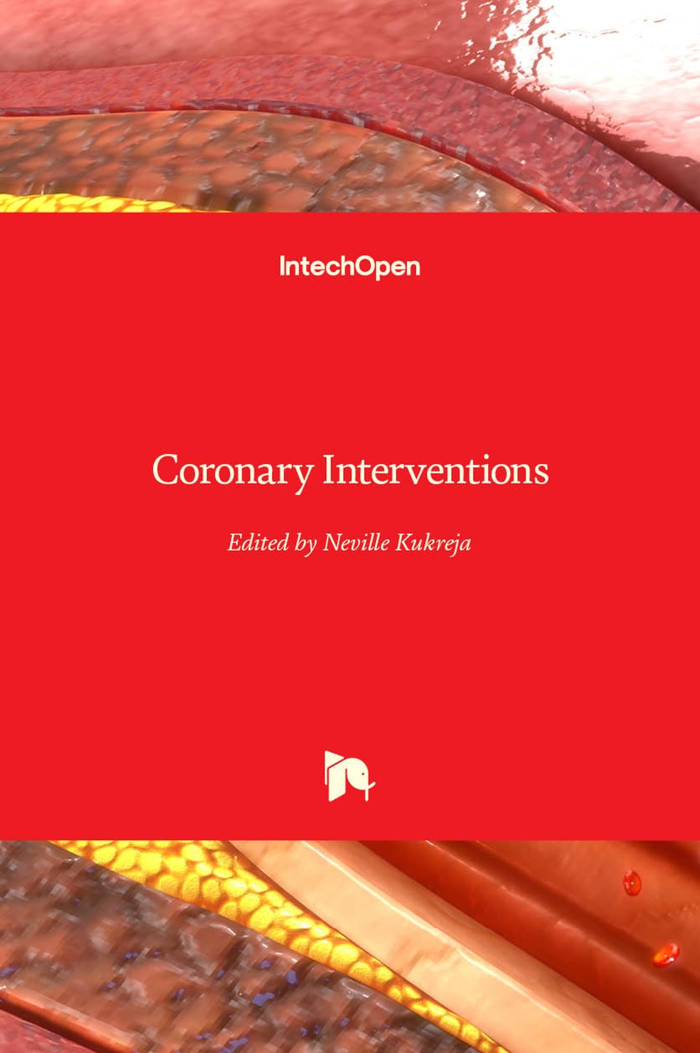 Buy Coronary Interventions — BookShops.in