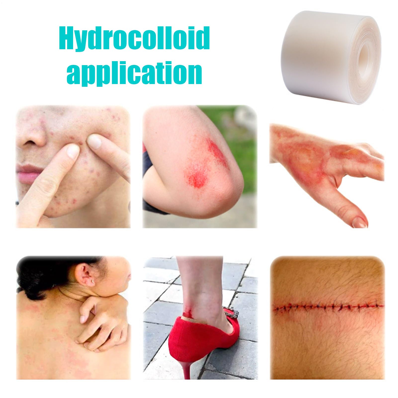 Cerotto Idrocolloide Cerotto Traspirante Flessibile Delicato Sensibile per | Medicazione Idrocolloide Cura Incisioni Pelle Sensibile Brufoli Viso Dita Tallone Piede Nuoto U
