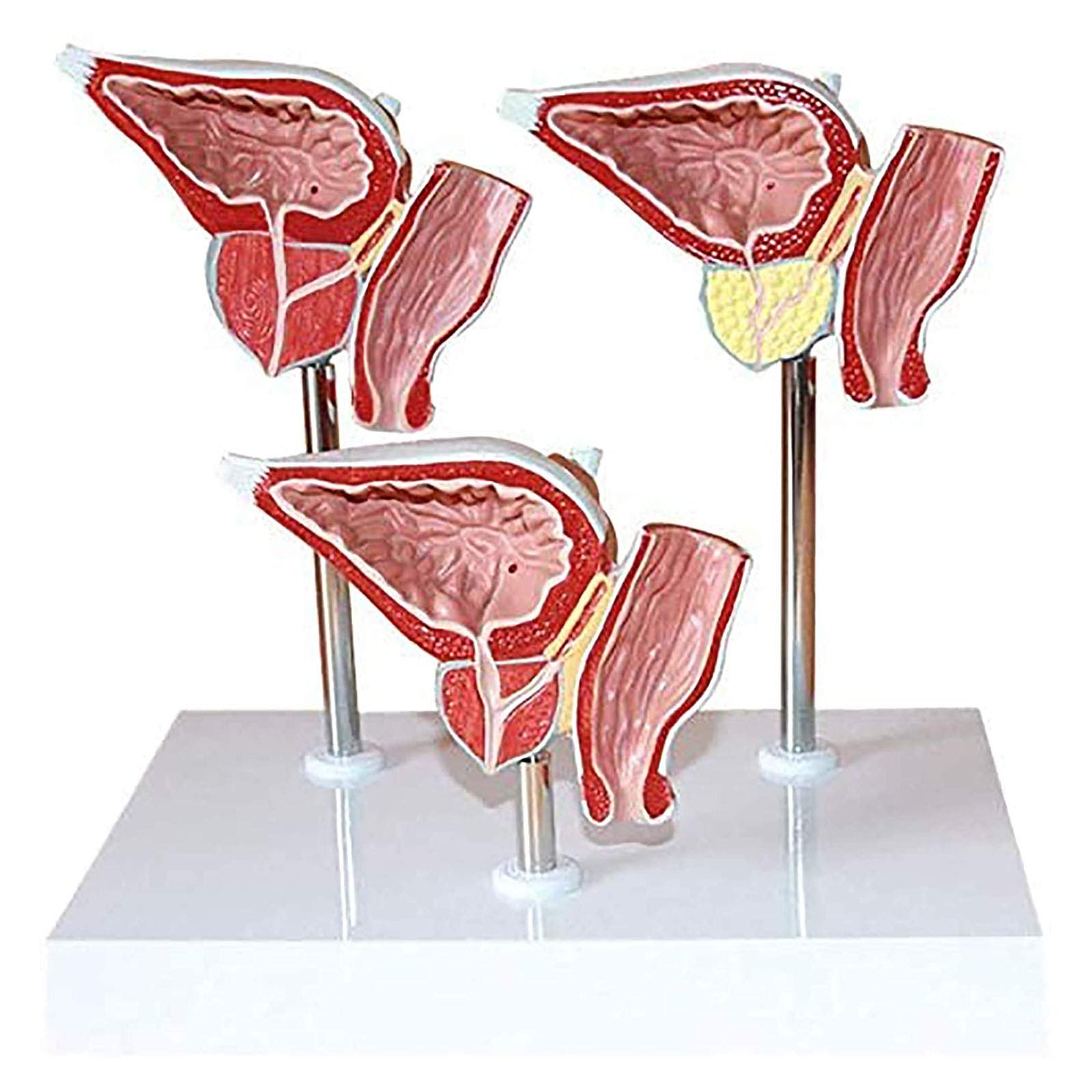 Anatomiemodelle, Anatomisches Modell des menschlichen Harnsystems