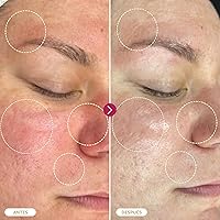 Vista 5 de BASE LABORATORIES Aerosol de ácido hipocloroso para rostro y piel 8oz Solución de reparación diaria de la piel facial para piel sensible