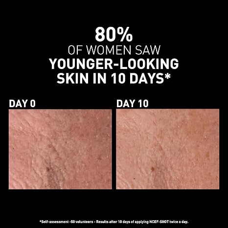 Filorga NCEF-Shot Anti-Aging Serum, Concentrated Wrinkle Reducing Treatment for Radiant & Firm Skin in 10 Days