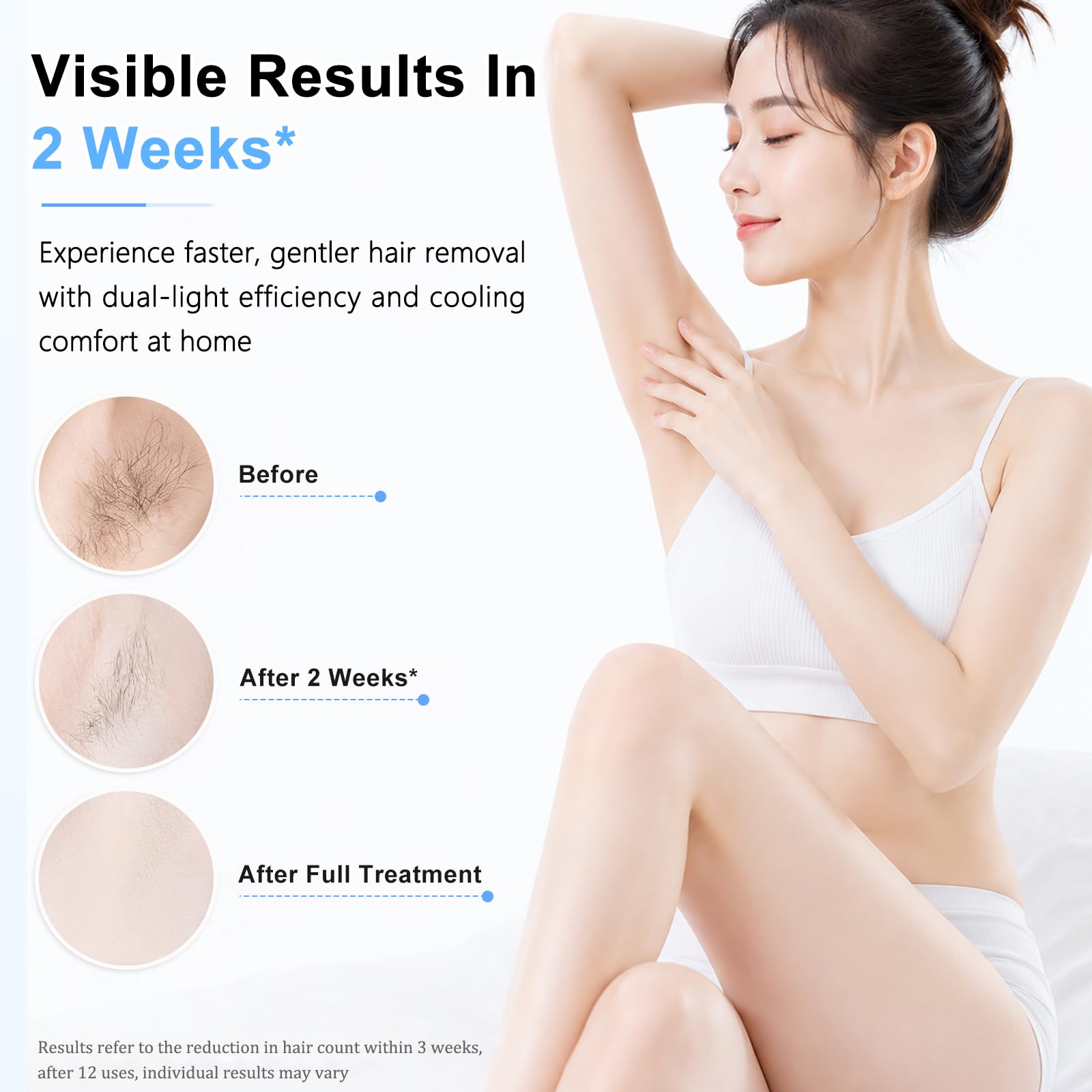 Epilatore Luce Pulsata, 999.999 Flash SHR/AUTO per Donne e Uomini, Bianco | Epilatore Laser con 3 livelli per Ascelle, Gambe, Bikini, Viso. Adatto a Donne e Uomini. Depilazione efficace e sicura