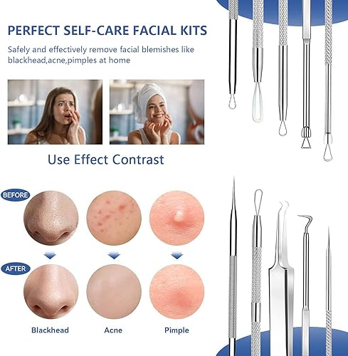 Miniatura 9 de Kit de herramientas para eliminar puntos negros, 15 unidades, extractor de cabeza negra para acné, comedona, espinillas, espinillas, espinillas,