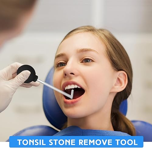 Miniatura 4 de TrelaCo Herramienta de extracción de piedra de amígdala, tubo de vidrio, herramienta de ventosas de piedra de amígdala, removedor de piedra de