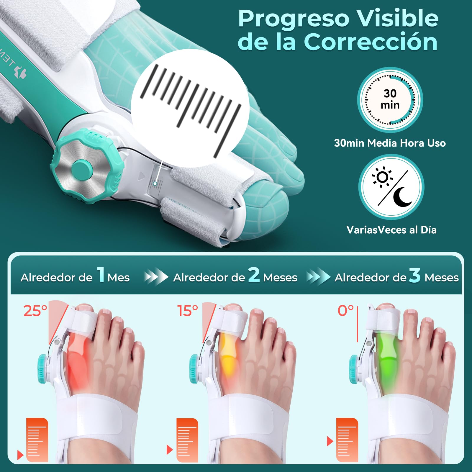 Corrector de Juanetes Botón Ajustable Corrector Juanetes Mujer Hombre Separador Dedos Pie para Hallux Valgus Protector Dedos Pie 1 Unidad