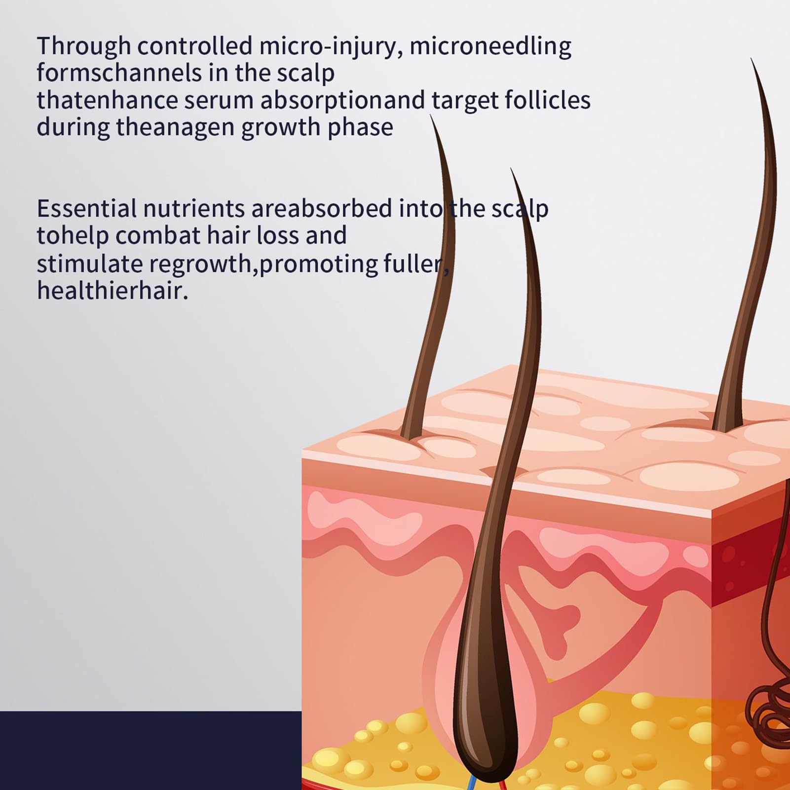 de crecimiento del cabello, juego estimulador de raíces nutritivas, solución de cuidado del cuero cabelludo con dispositivos de microagujas, promueve el crecimiento del cabello, la renovación