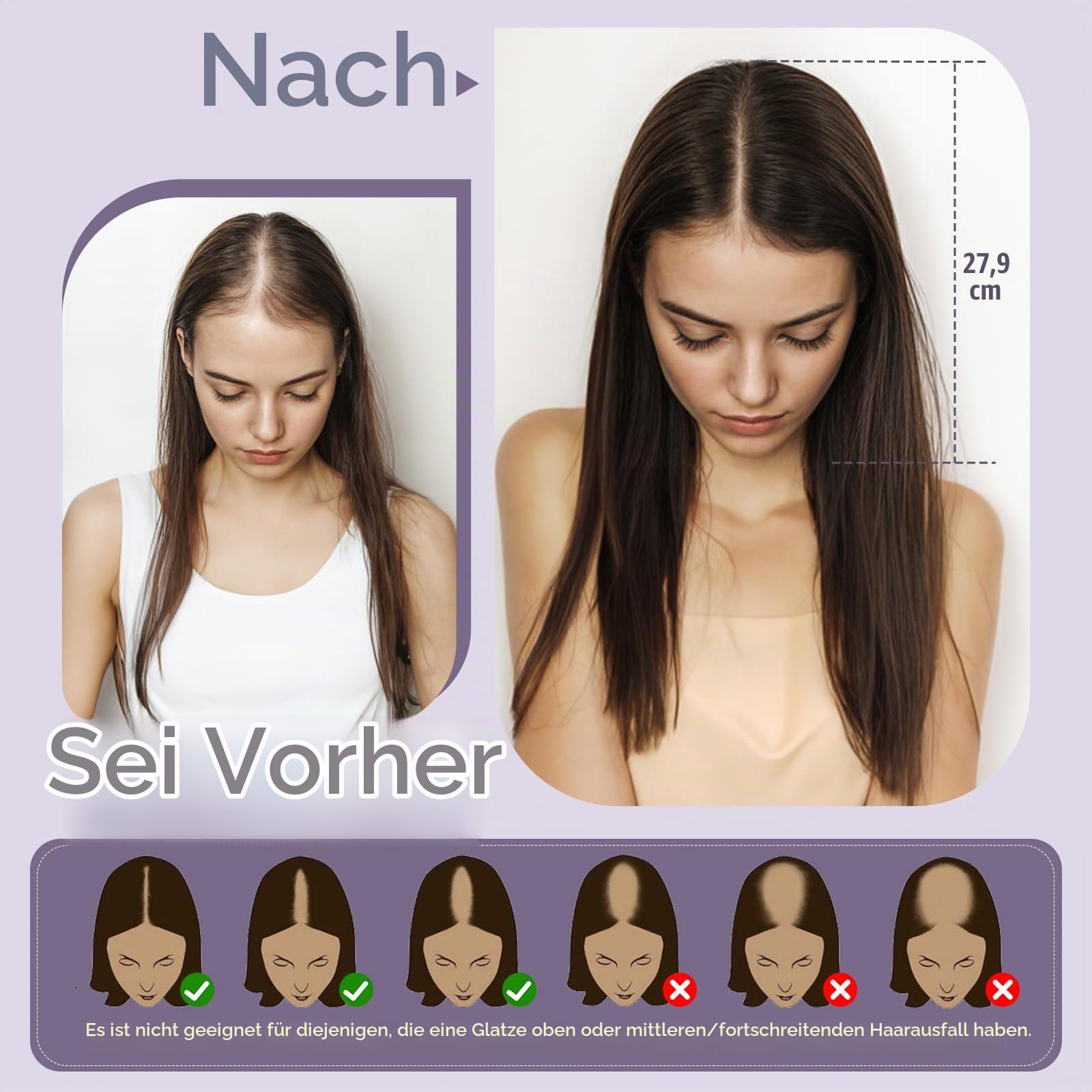 S-noilite Topper Haare für Frauen Echthaar Dunkelbraun - 8x11cm 100% handgeknüpfte Toupets mit Seitenpony Haar Toppers Echthaar Damen Haarverdichtung 21 Gramm