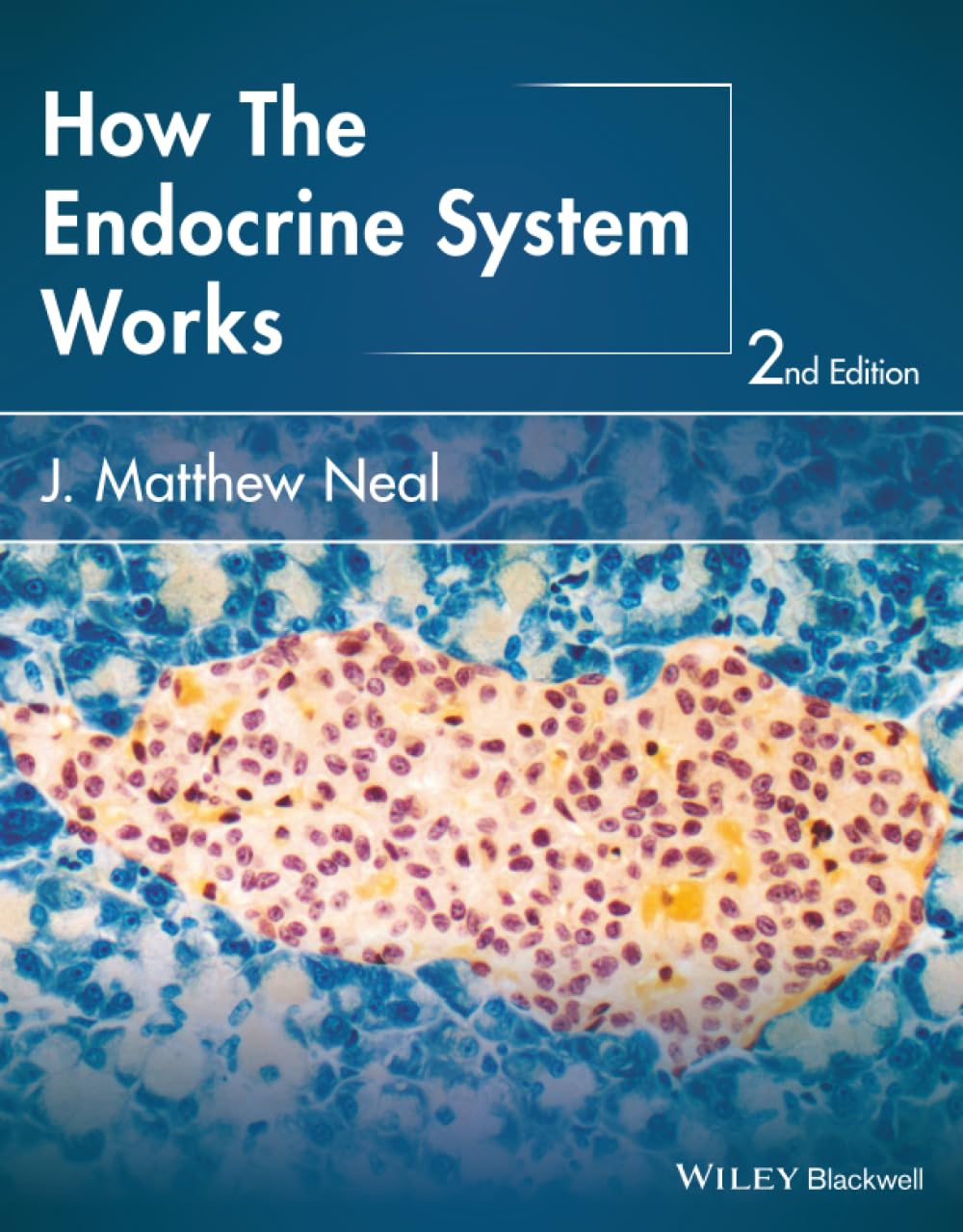 How the Endocrine System Works (The How it Works Series)      2nd Edition