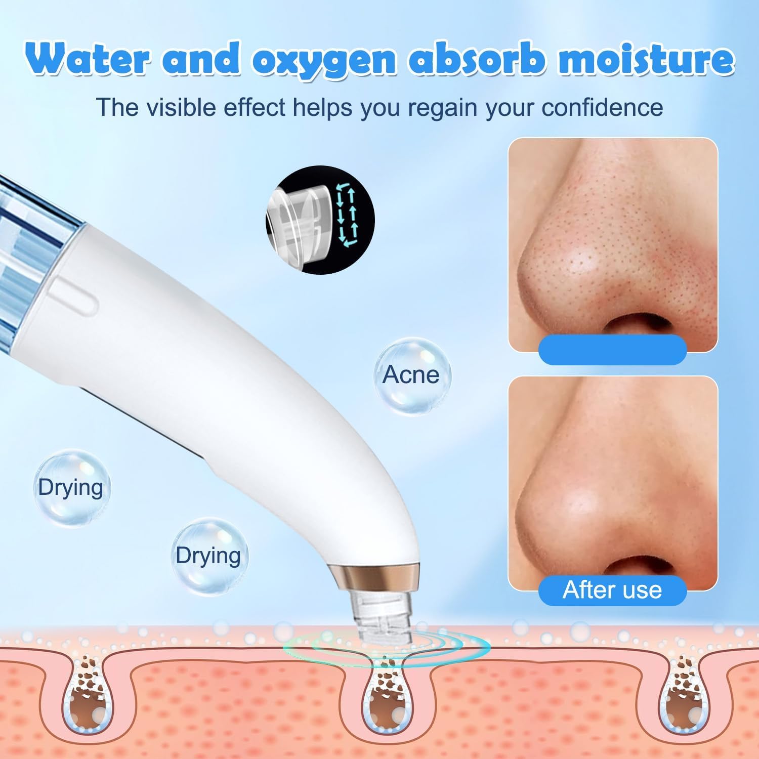 Aspirateur Point Noir Extracteur de Comédons Nettoyage des Pores avec 6 Sondes et 3 Modes, Professionnel Extracteur de Point Noir Electrique Tire Nettoyant de Pores Soin Visage