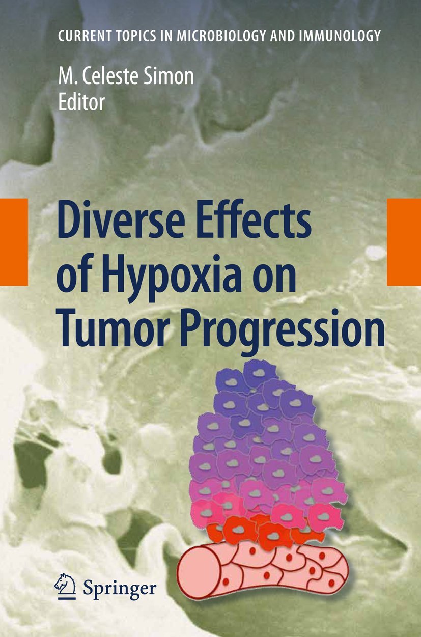 Diverse Effects of Hypoxia on Tumor Progression (Current Topics in ...
