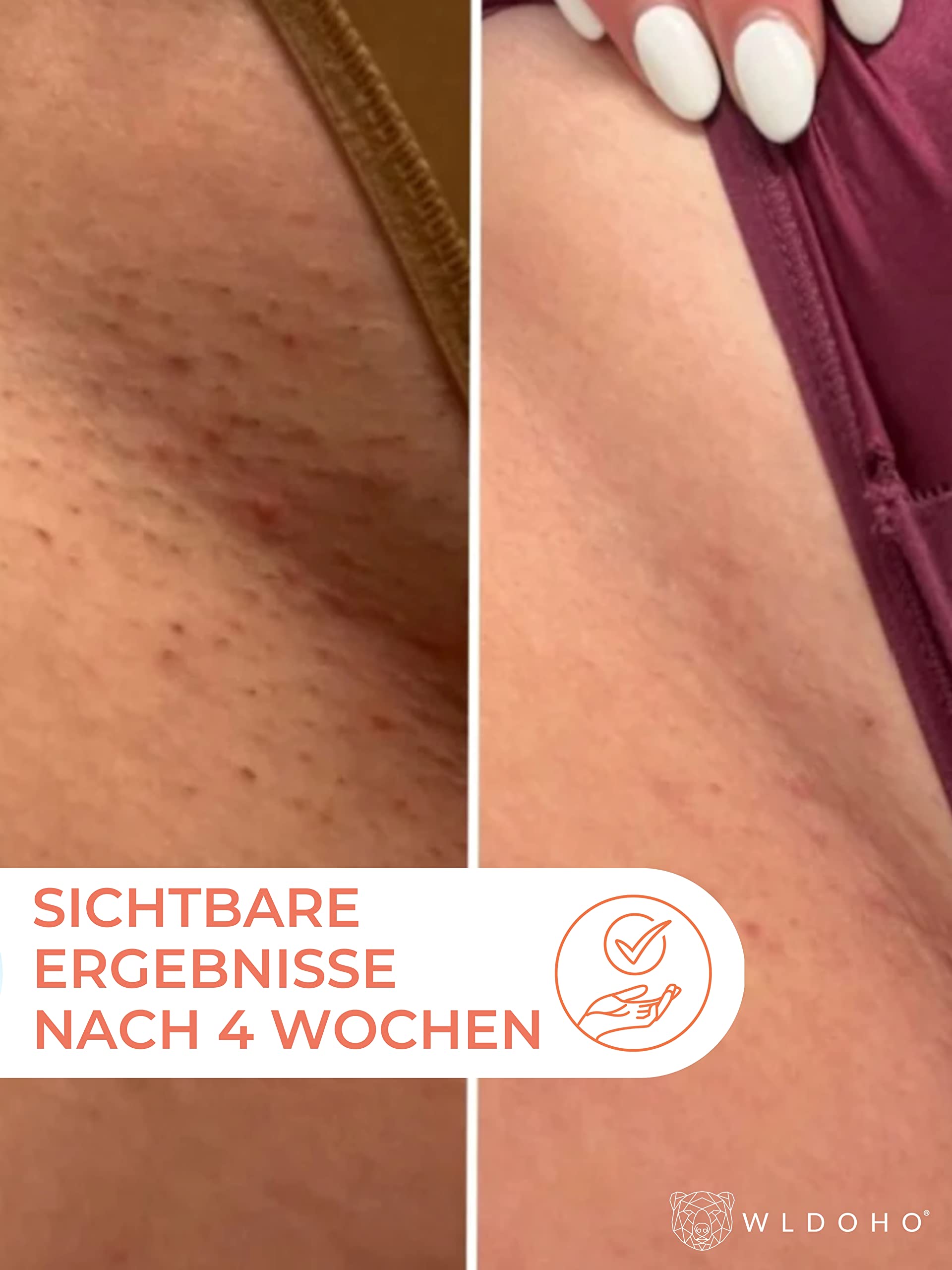 WLDOHO® Intim Rasieröl für Damen - Sanfte Pflege für den Intimbereich Shaving Oil - Hilft gegen Juckreiz & Rasierpickel - After Shave Damen Intimbereich - Made In Germany - Doppelpack