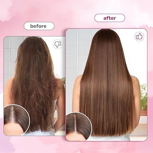 Miniatura 3 de Gomitas para el cabello, la piel y las uñas, biotina (10,000 mcg) Suplemento vitamínico para el cabello, la piel y las uñas, para mujeres, hombres,