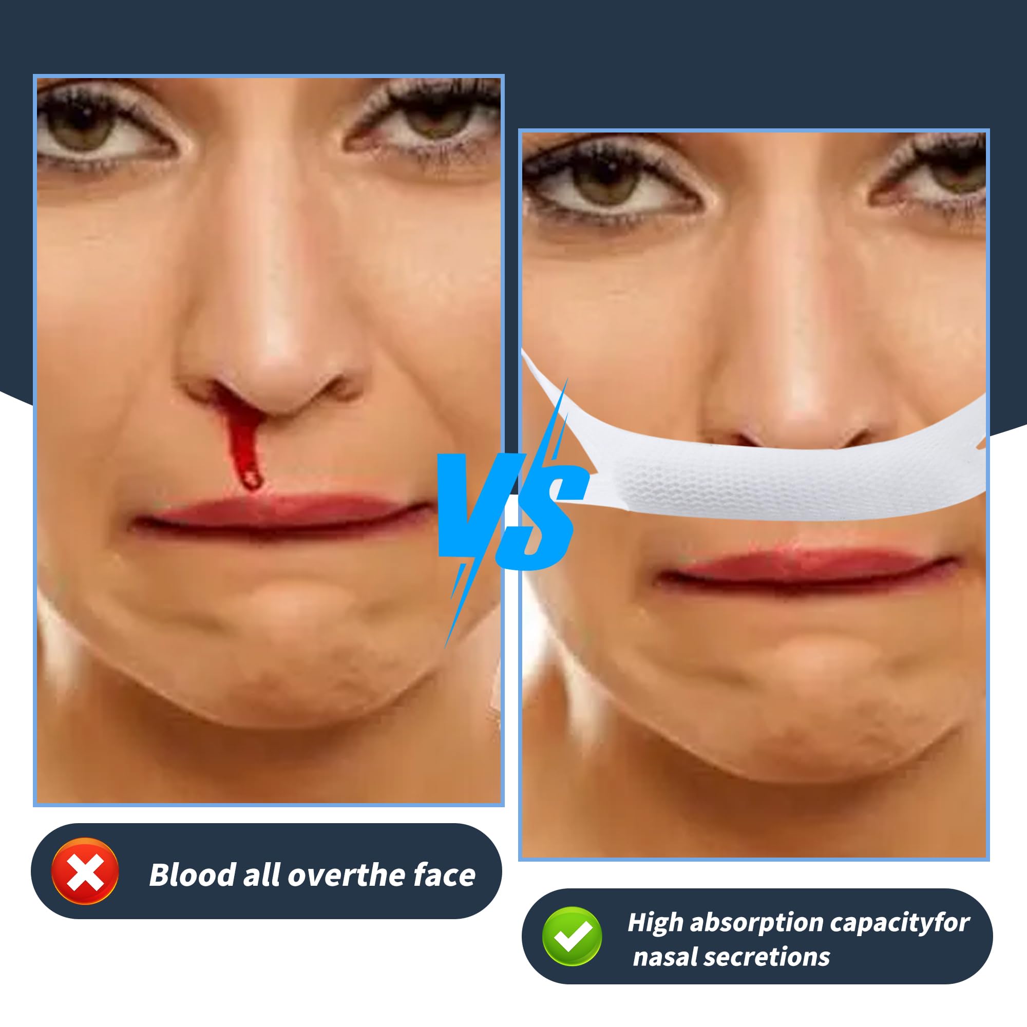 20pcs Elastic Nose Bandage for Septoplasty Recovery, White — Amazon image 4