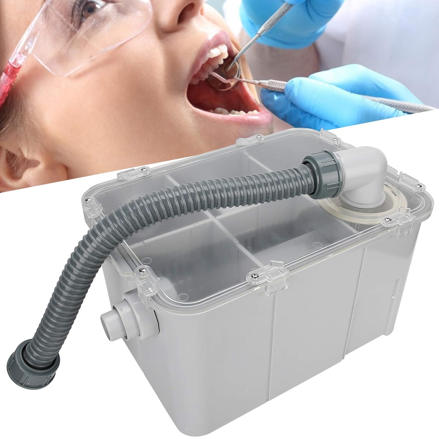 Gypsum Filter, Plaster Filter - Plaster Sedimentation Equipment Kit for Procedures & Labs