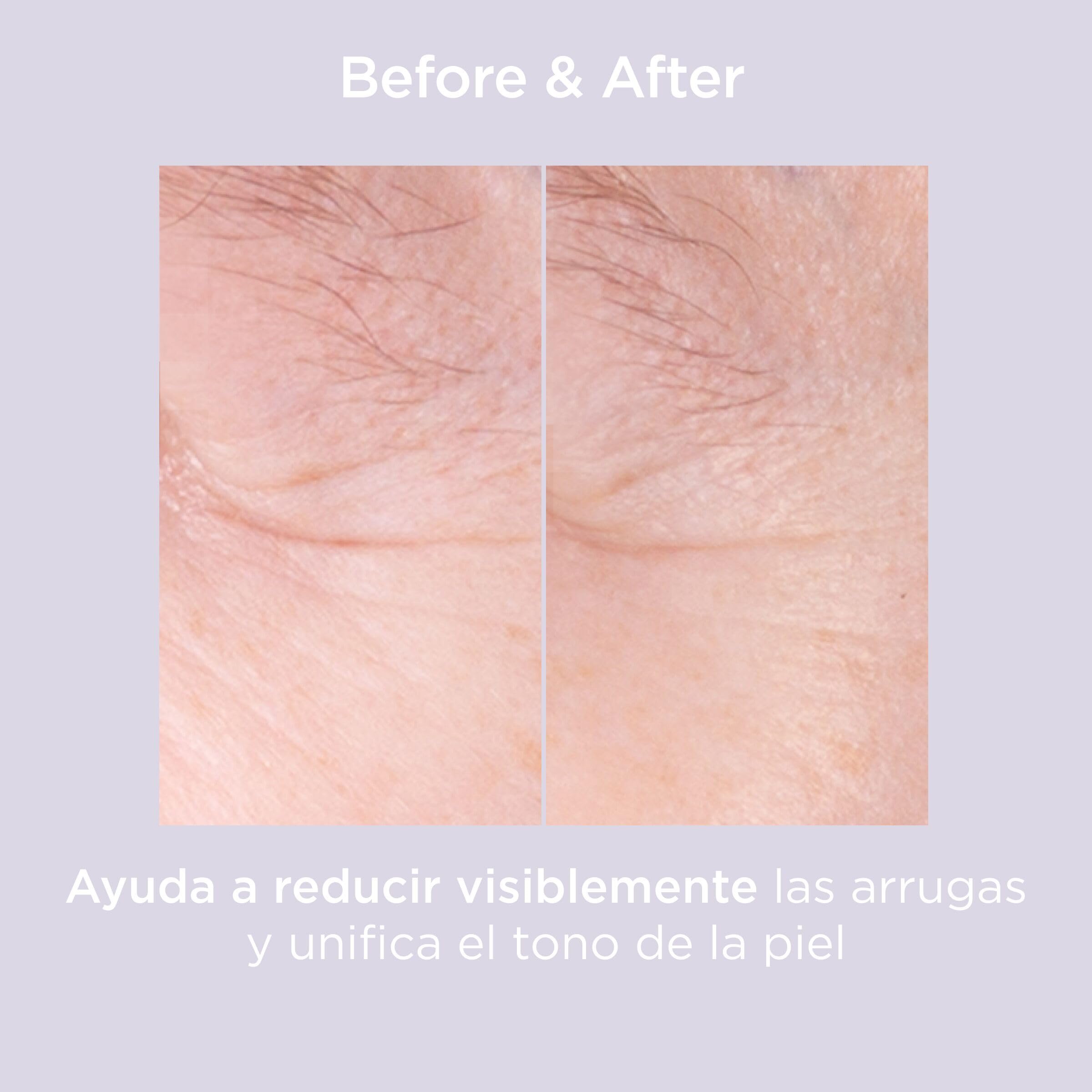 Isdinceutics Glicoisdin 15 Moderate, Gel Facial Efecto Peeling con Ácido Glicólico, 50 ml