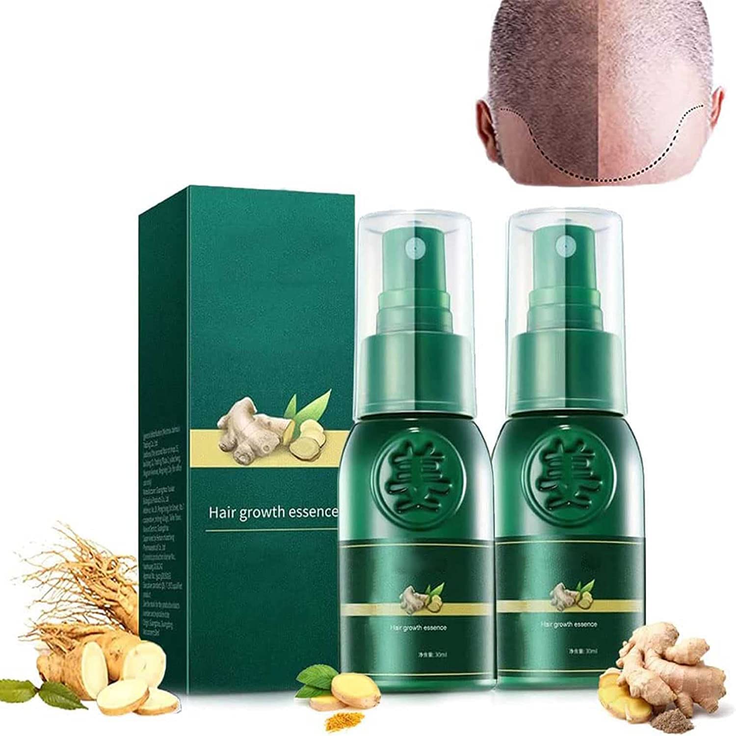 Buy Korea Ginseng Hair Regrowth Serum Spray,Ginger Hair Growth Spray