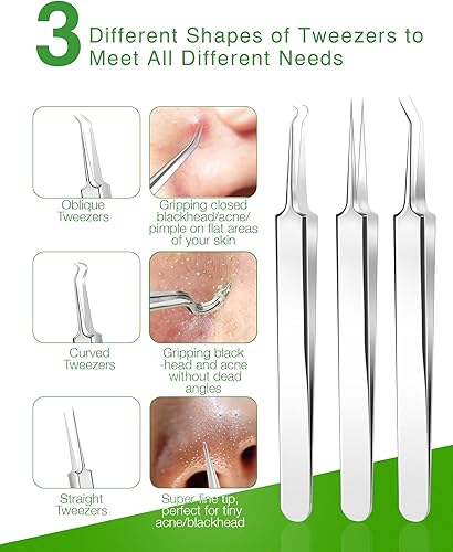 Miniatura 3 de Kit de herramientas de extracción de espinillas herramienta de extracción de puntos negros herramienta extractora de puntos negros para cara