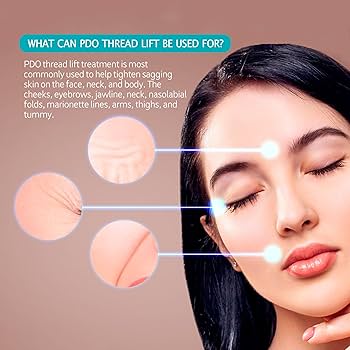 Amazon.com : RYZESKI PDO Mono Threads Lift, for Face and