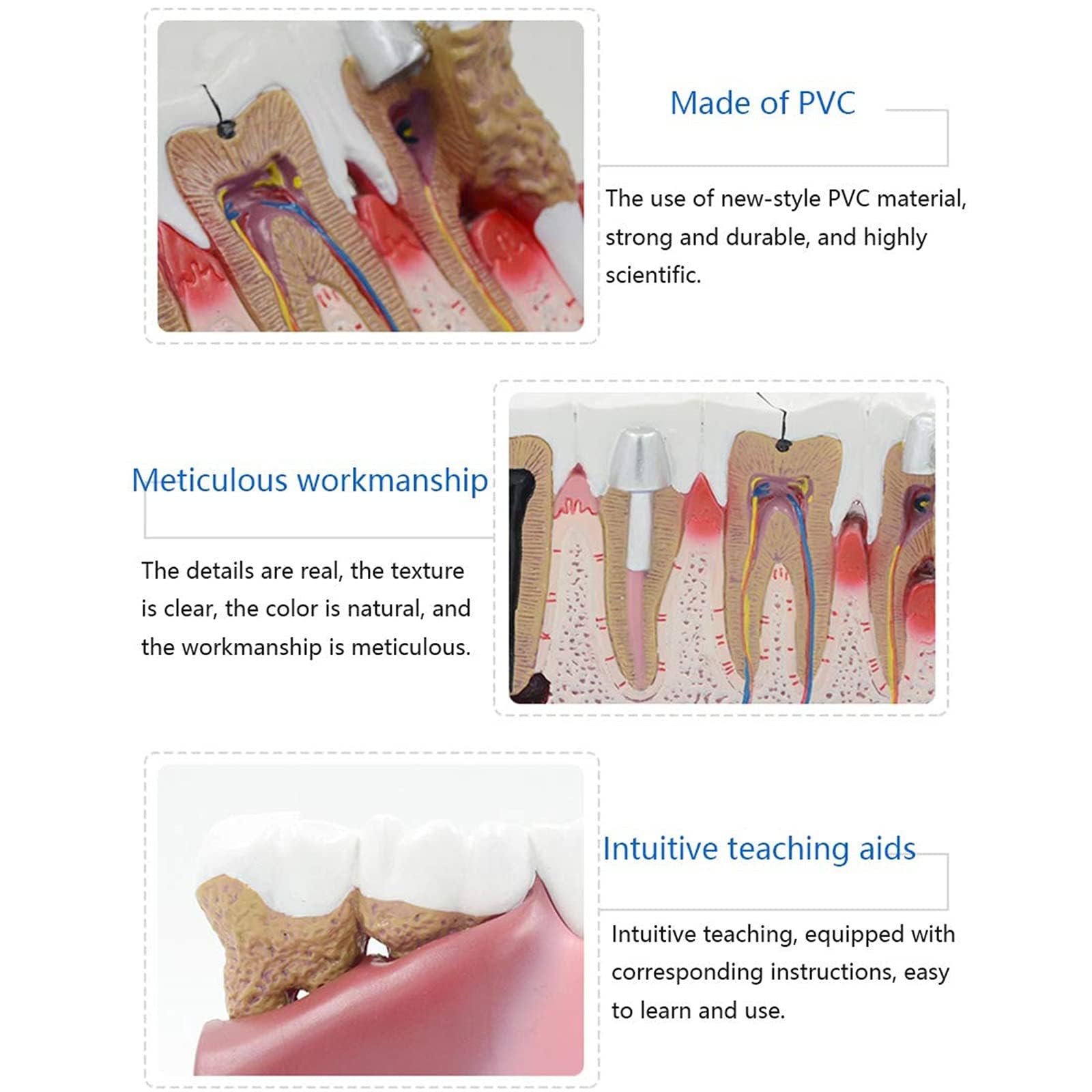 Model zębów dentystycznych, model anatomii zębów ludzkich, z instrukcjami, demonstracja patologii, model dentystyczny, do gabinetu dentystycznego, narzędzie edukacyjne