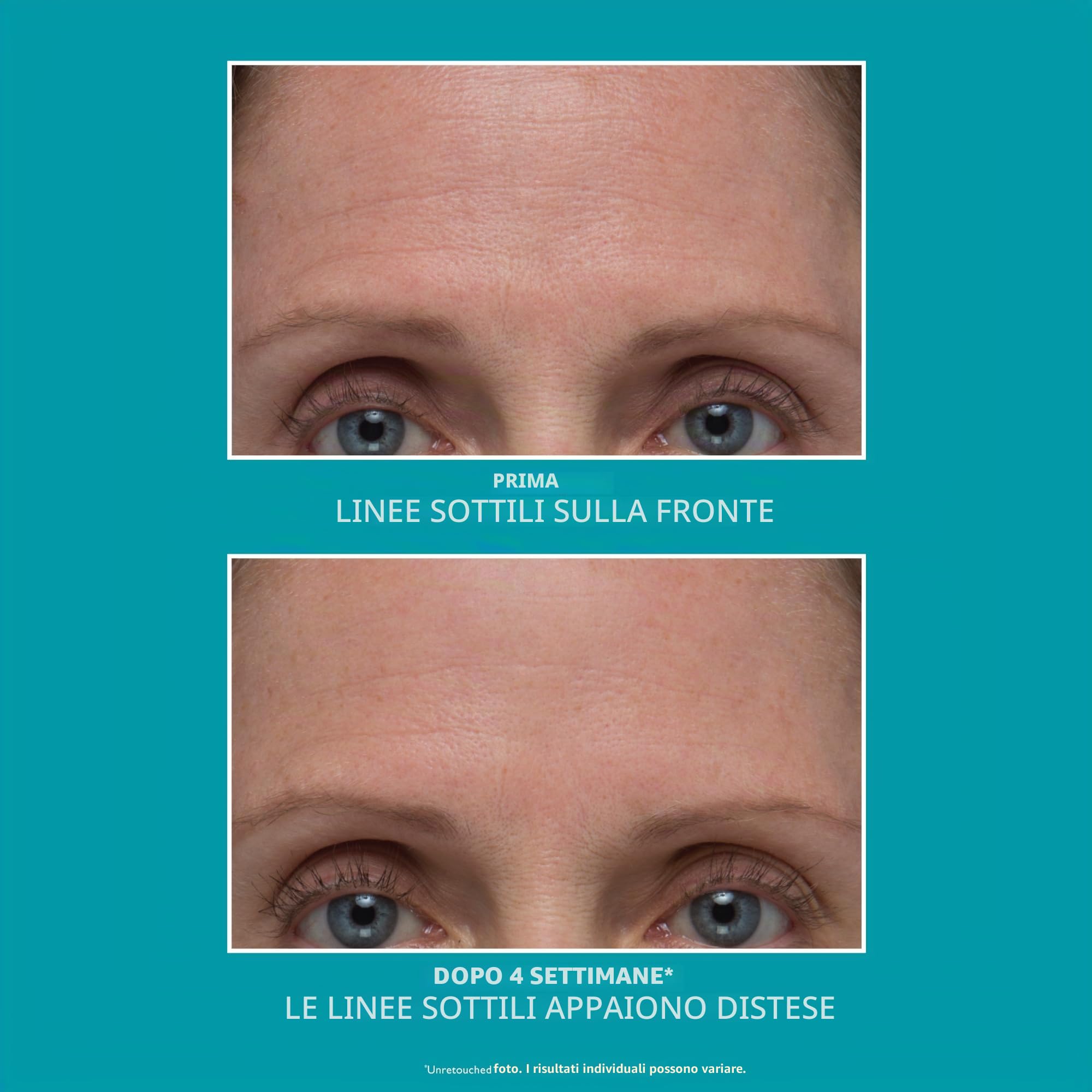 Peter Thomas Roth - Siero antirughe Peptide Skinjection™ Ricaricabile – Siero anti-invecchiamento con peptidi, cura levigante e idratazione intensa