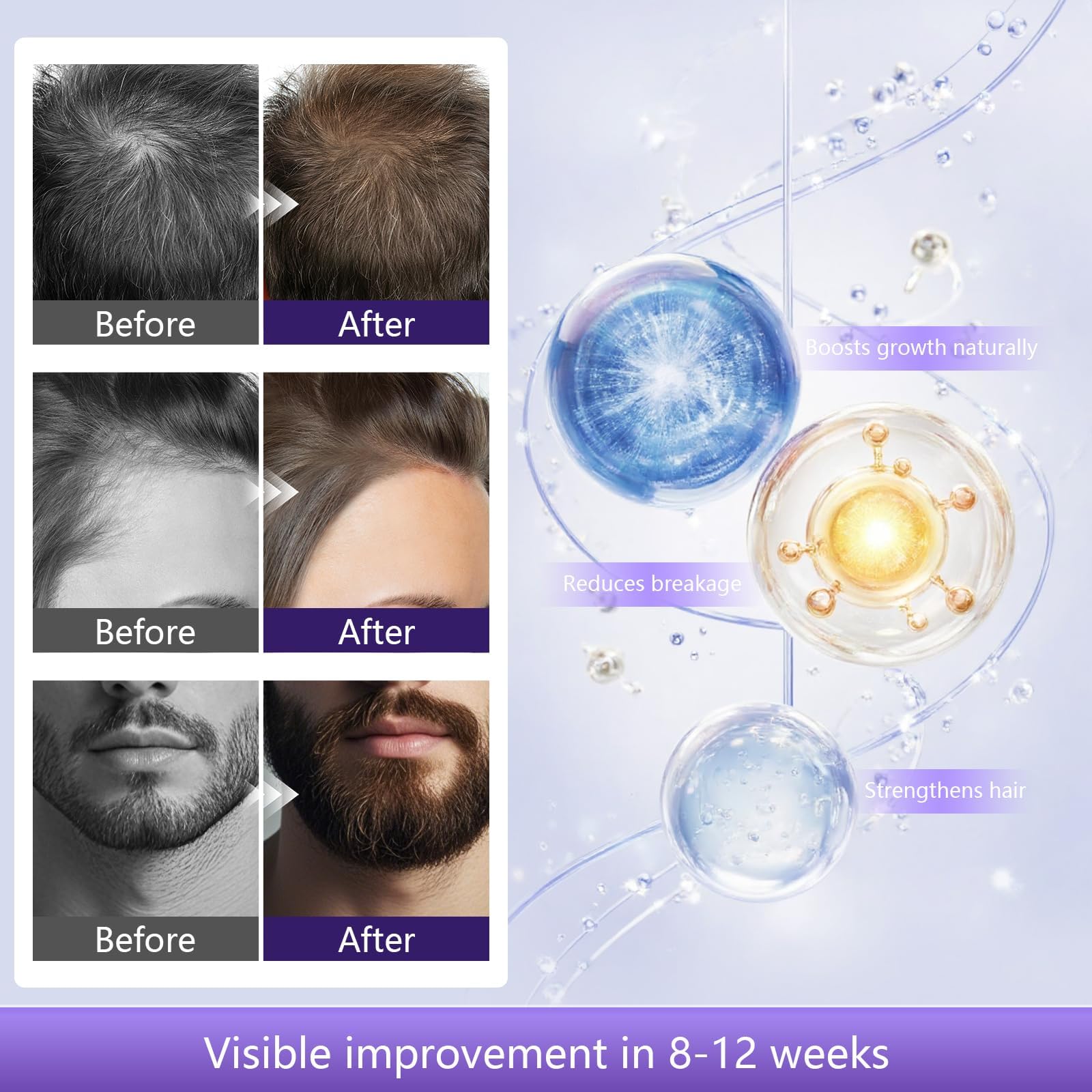 Serum Pousse Cheveux, Biotine, Romarin & Batana Oil Spray for Hair Growth, Anti Effluvium Chute de Cheveux Femme et Homme, Favorise la Croissance Capillaire, Non Gras, Pousse Barbe, 60ml