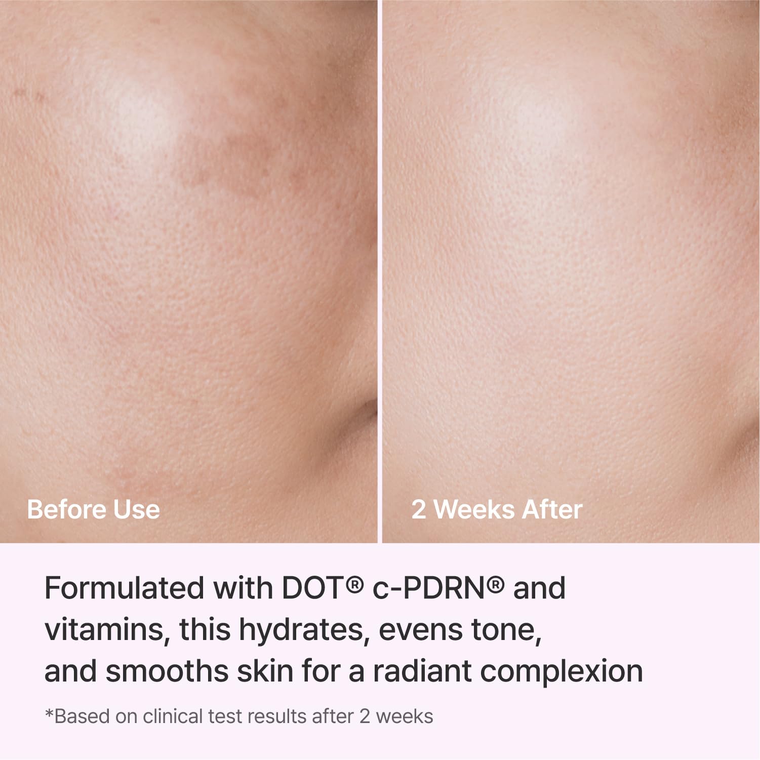 REJURAN Crema Idratante Triple Radiance 50 Ml Dot C Pdrn 0,2% Con Niacinamide E Pantenolo, Idratante, Tono E Consistenza, Per Una Pelle Liscia, 1,7 Fl Oz (Confezione Da 1) Bianco | Con Niacinamide E Pantenolo, Tono E Consistenza, Per Una Pelle Liscia, Con