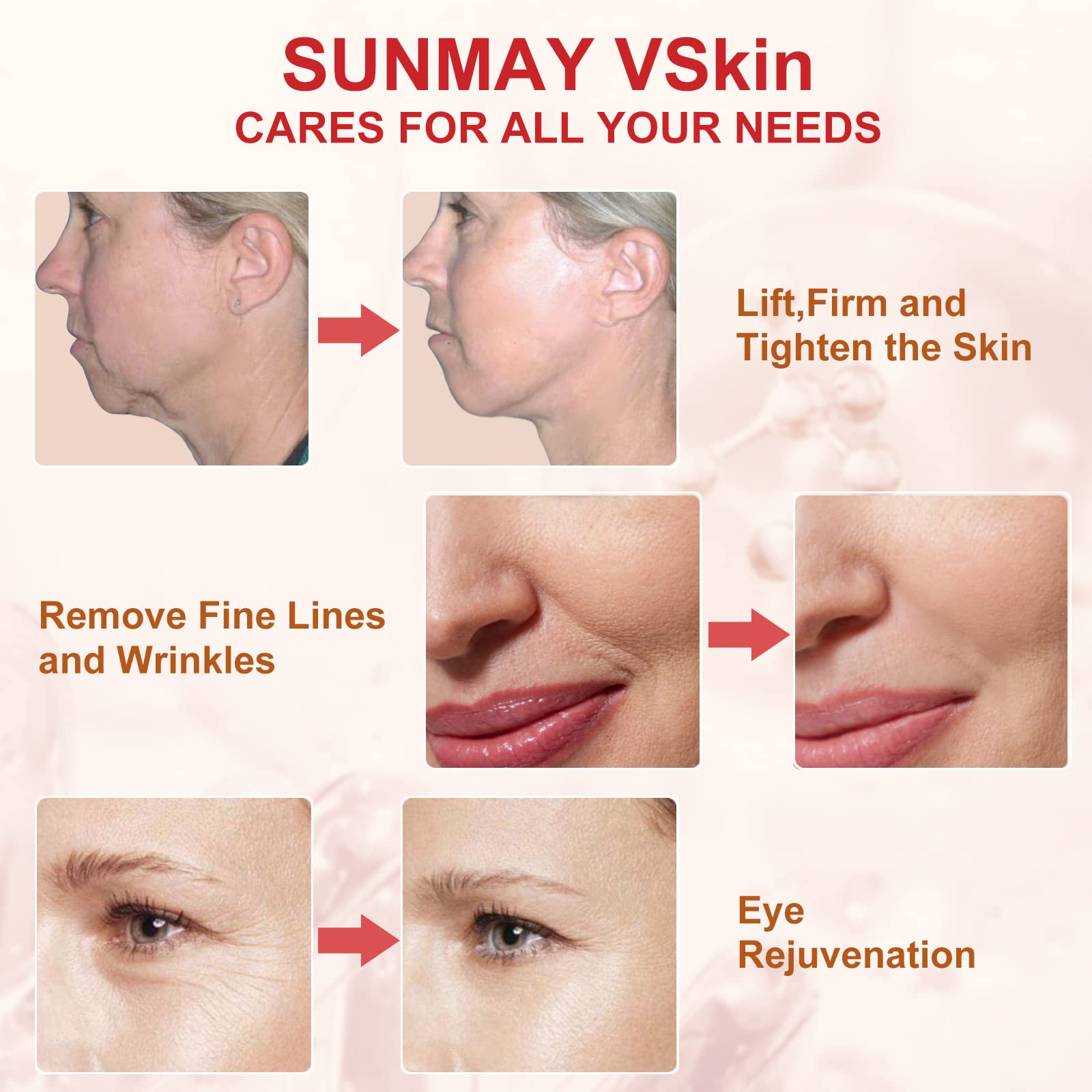 SUNMAY VSkin Radiofrequenz Gesichtsmassagegerät Anti-Aging Faltenreduzierung EMS Hautpflegegerät