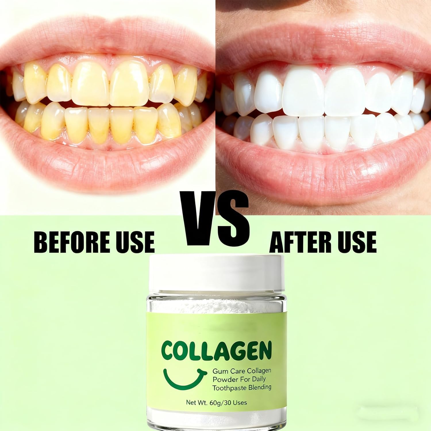 Collagen Powder for Gums - Collagen Tooth Powder for Gums - Hydroxyapatite Toothpaste Care Powder Protect Gum - Mineral-Infused-Collagen Formula 60g (2)