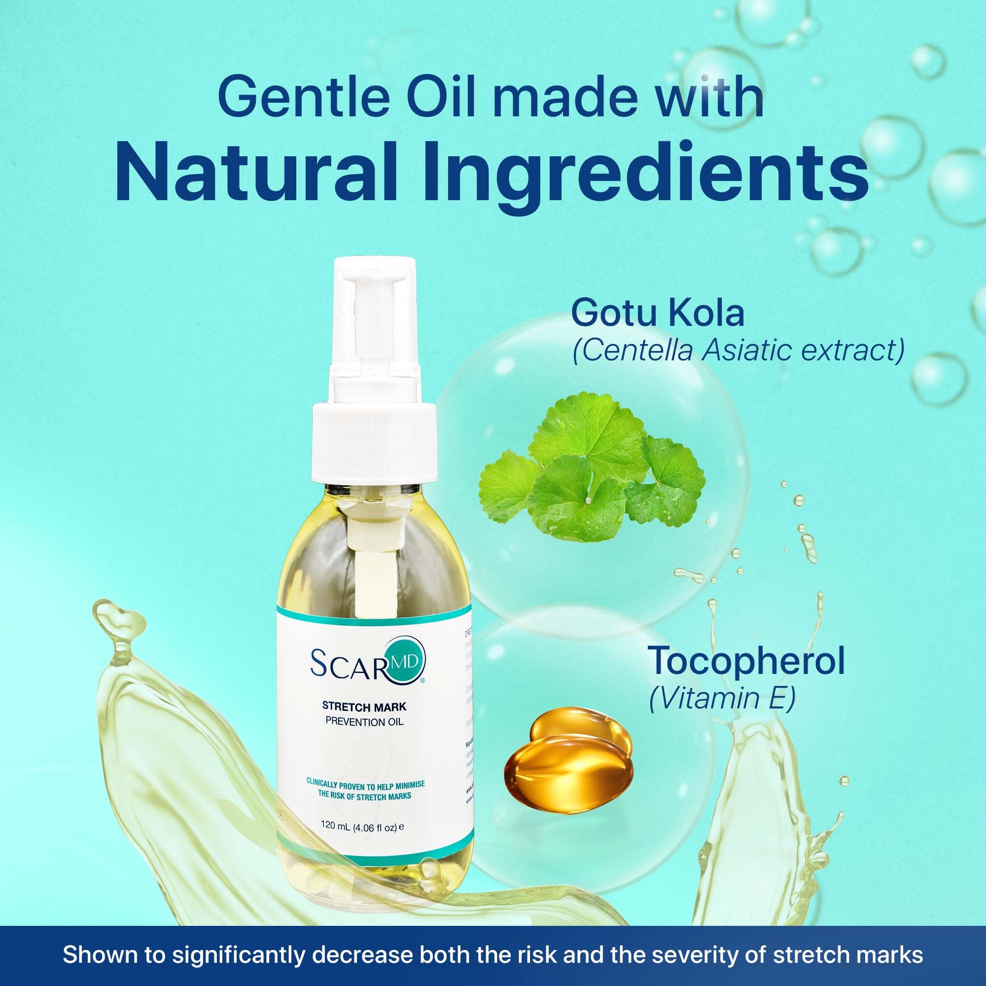 ScarMD Narbencreme & Dehnungsstreifen Entferner | 120ml Öl gegen Schwangerschaftsstreifen | Mit Vitamin E & Gotu Kola | Für Schwangere, Sportler & Jugendliche | Natürlich & Wirksam