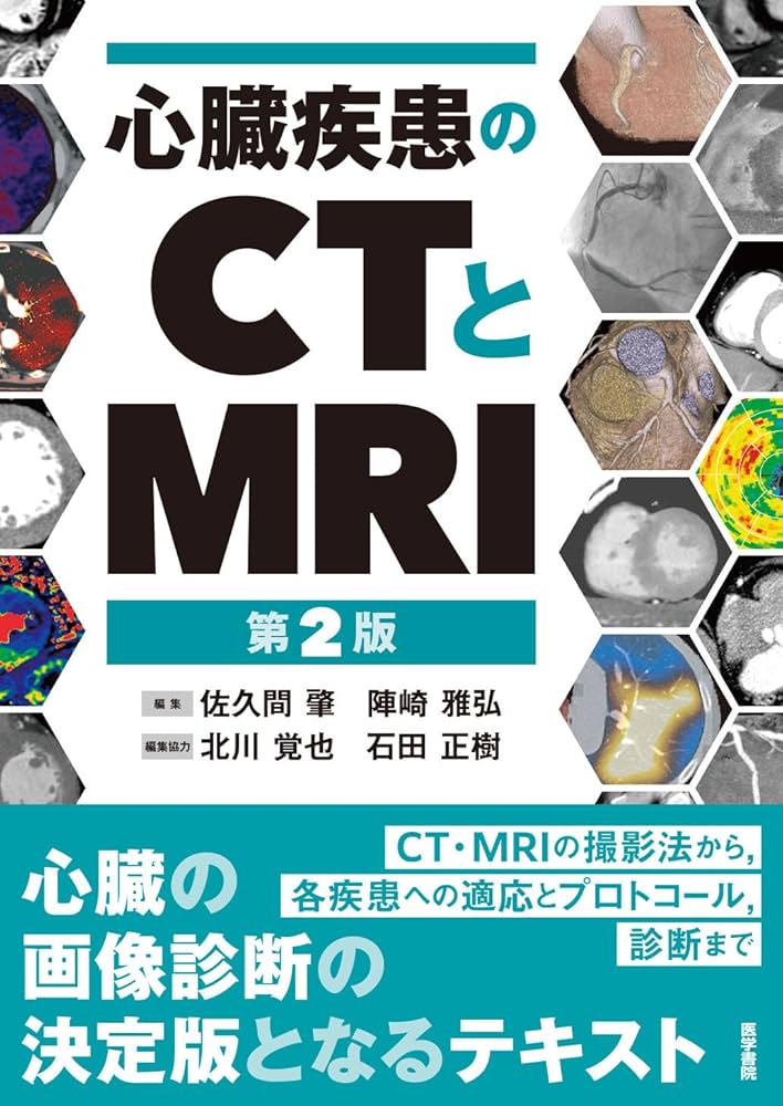 心臓疾患のCTとMRI 第2版 | 佐久間肇, 陣崎雅弘, 北川覚也, 石田正樹