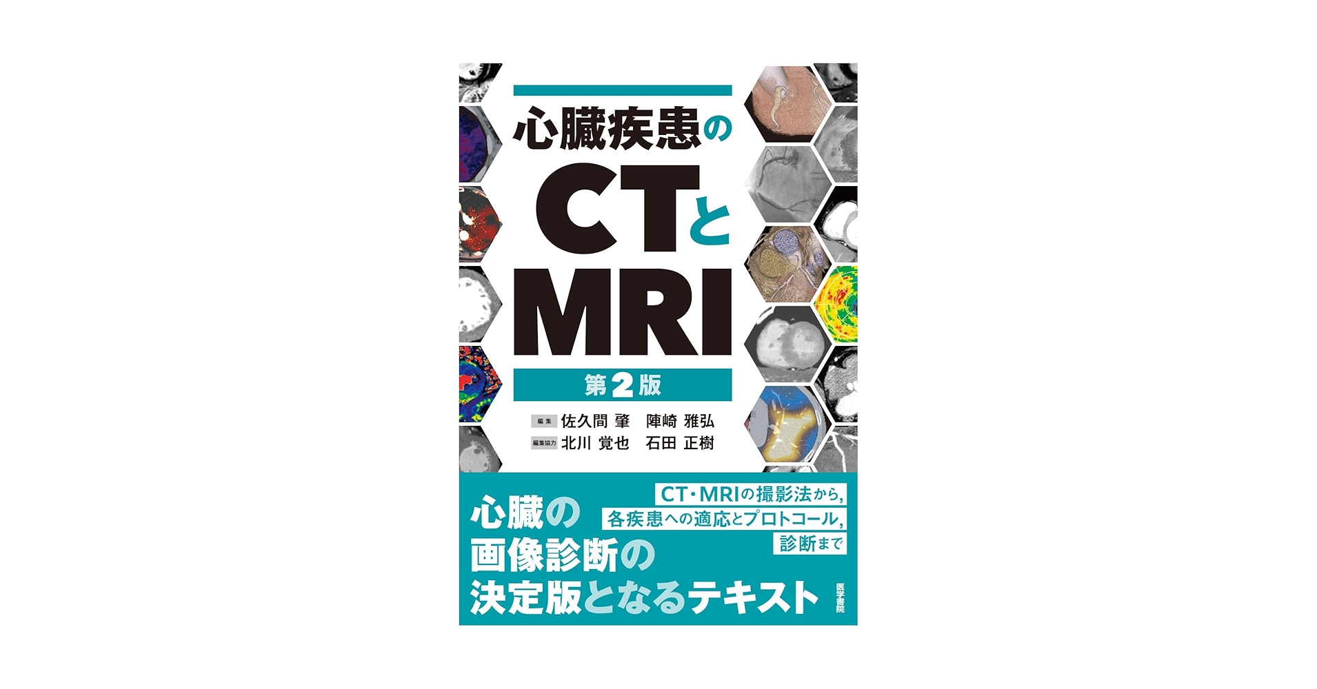 心臓疾患のCTとMRI 第2版　裁断済み 心臓疾患のCTとMRI 第2版 | 書籍詳細 | 書籍 | 医学書院