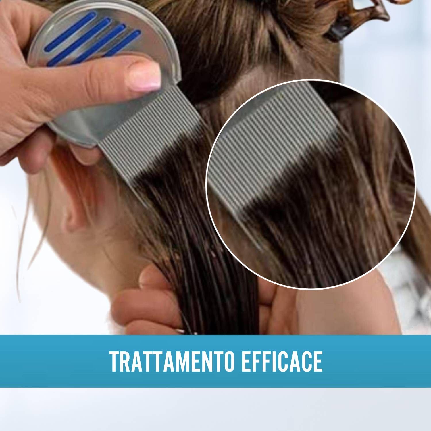 Pettine professionale per la rimozione di pidocchi e lendini con punte a coste, trattamento anti pidocchi e lendini