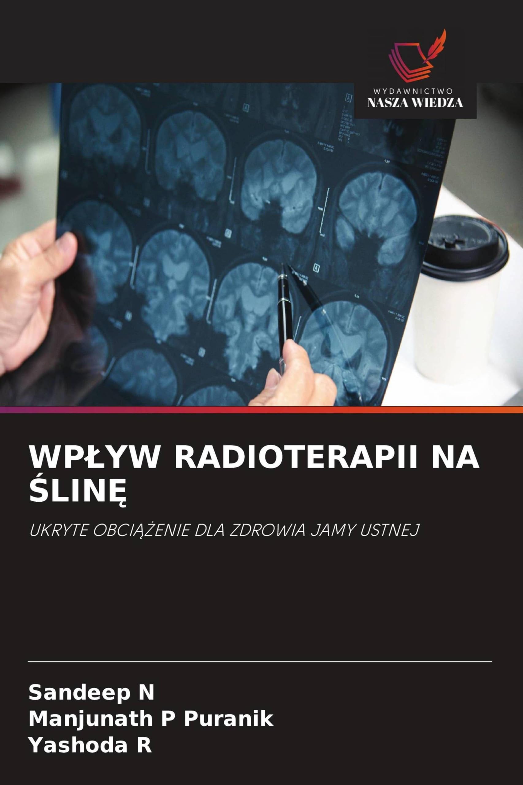 WP¿YW RADIOTERAPII NA ¿LIN¿: UKRYTE OBCI¿¿ENIE DLA ZDROWIA JAMY USTNEJ