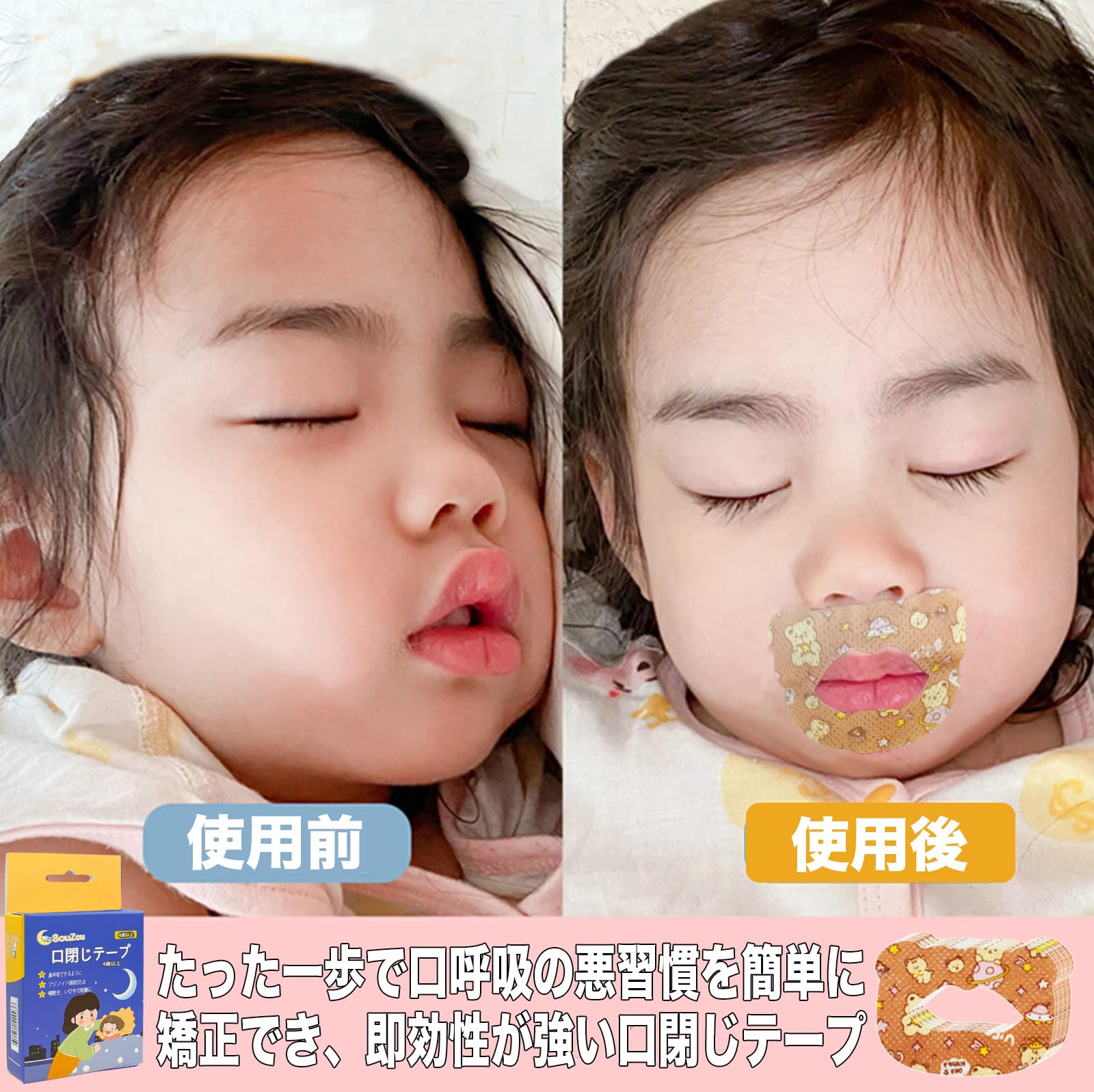 Amazon.co.jp: 口閉じテープ 子供用 口呼吸防止 鼻呼吸 アデノイド顔貌