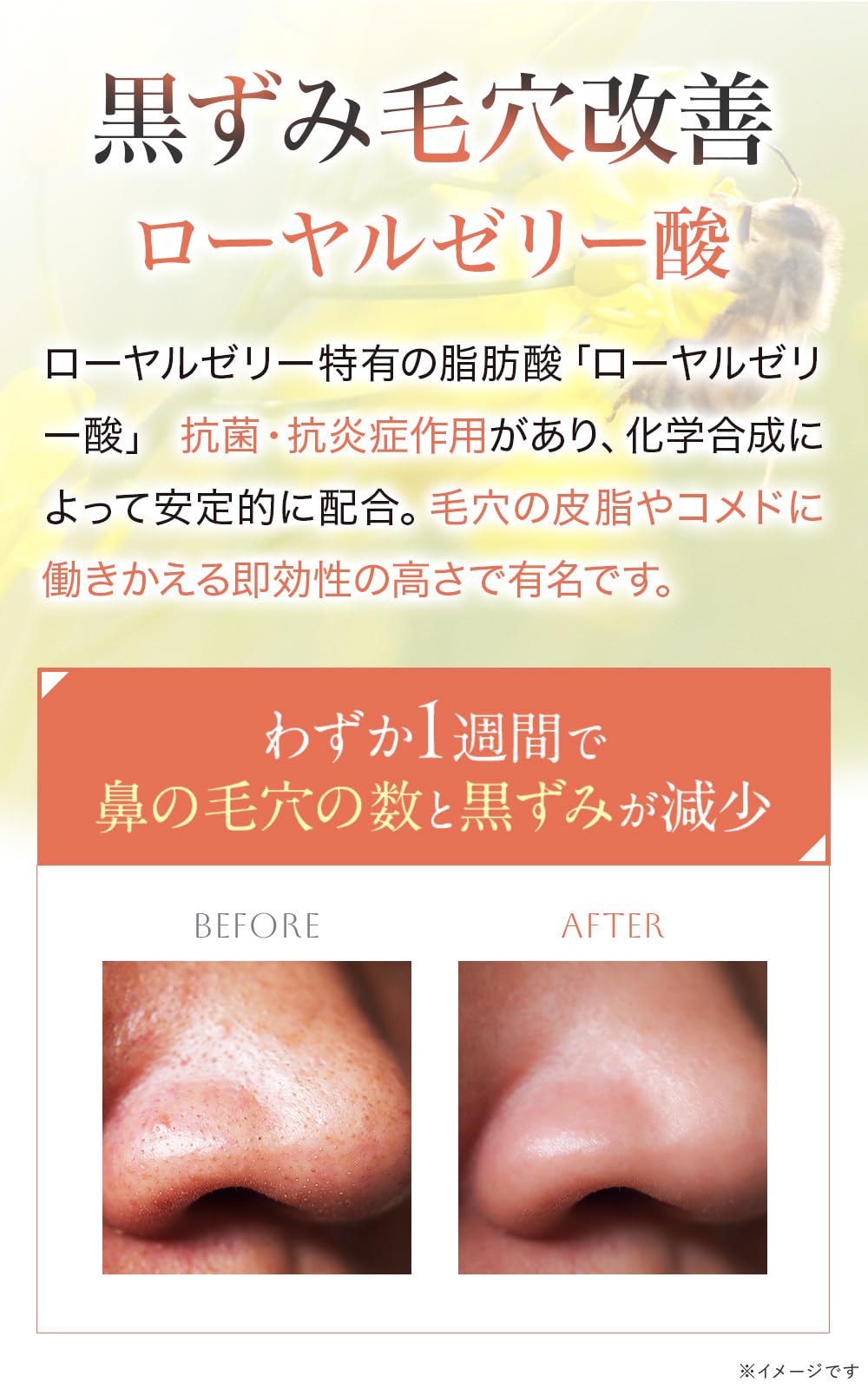 Amazon.co.jp: 【 5分で実感！肌水分爆上がり炭酸パック 】イクダム